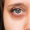 under eye
